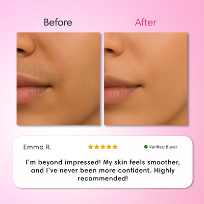 Hair Removal Trilogy Kit