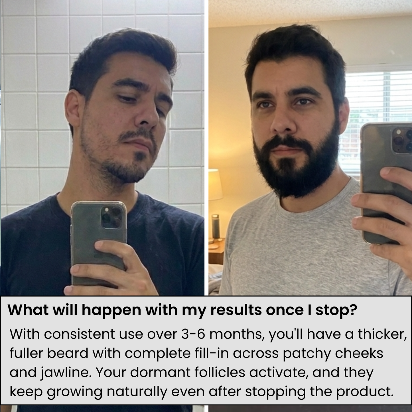 AlphaInfuse™ Beard Growth System