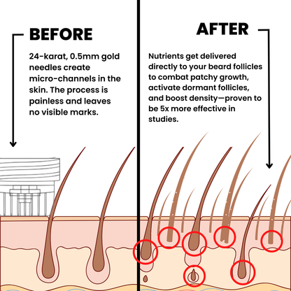 AlphaInfuse™ Beard Growth System